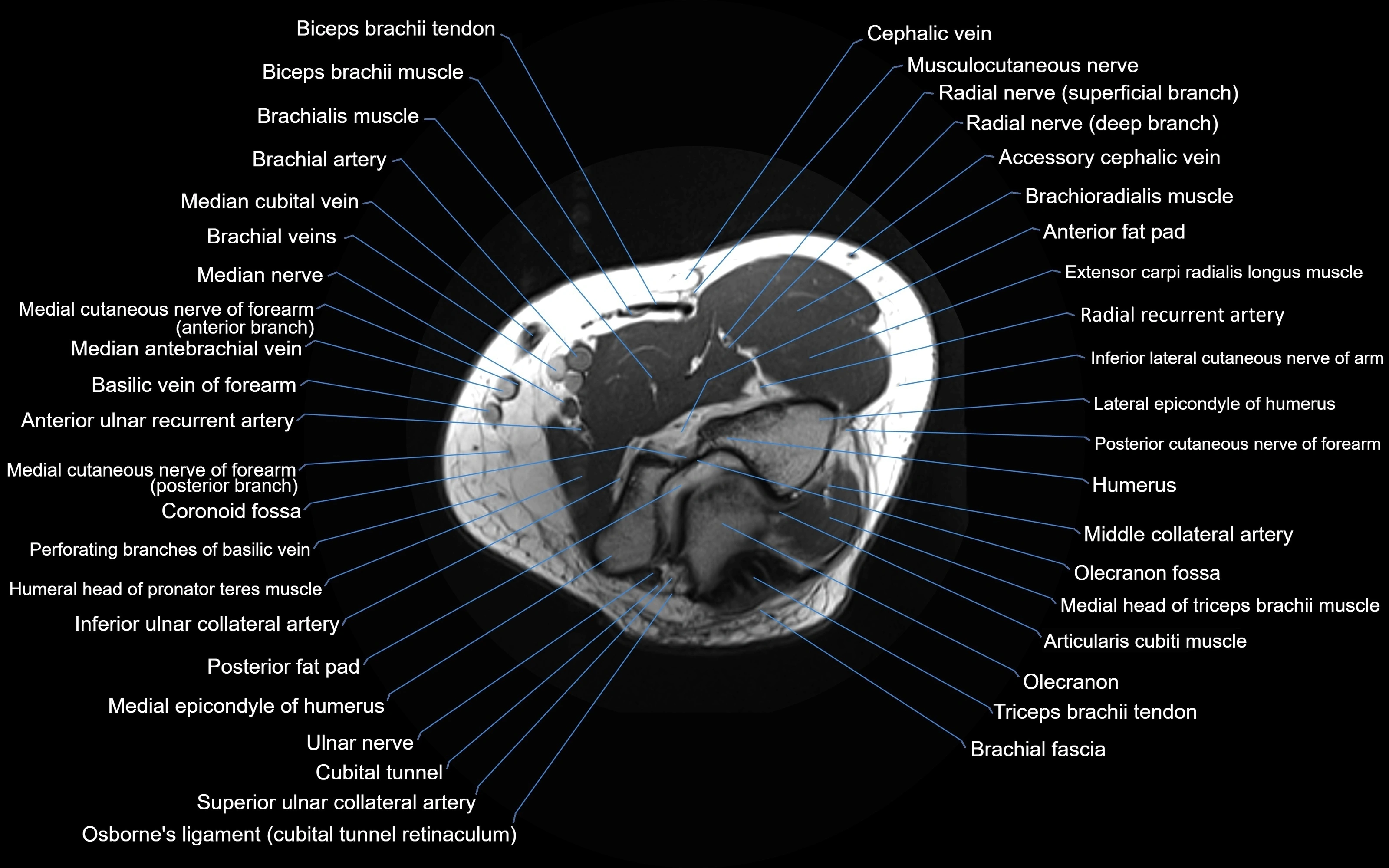 MRI elbow axial cross sectional anatomy 3T  radiology  image-img-00001-00010.webp
